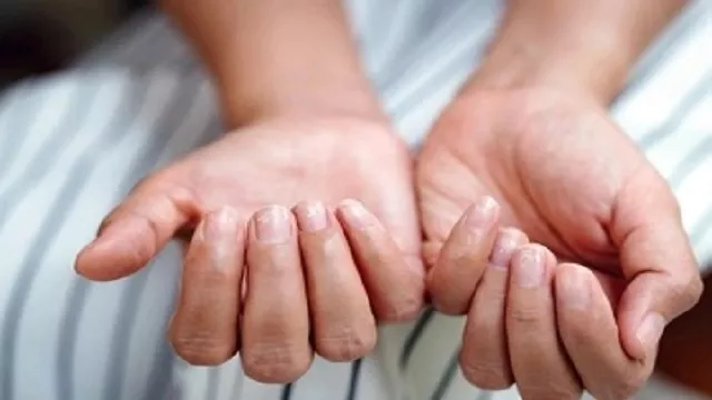 Những biểu hiện của tình trạng thiếu sắt