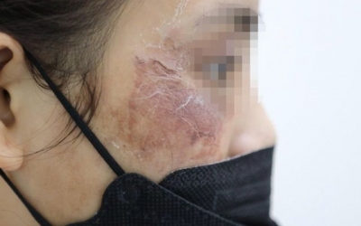 Mỹ phẩm online chưa thôi gây họa